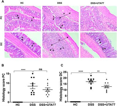 Short-Chain Naphthoquinone Protects Against Both Acute and Spontaneous Chronic Murine Colitis by Alleviating Inflammatory Responses